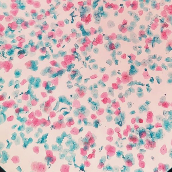 YGR® Adhesion Microscope Frosted Slide 75*25mm - Image 5