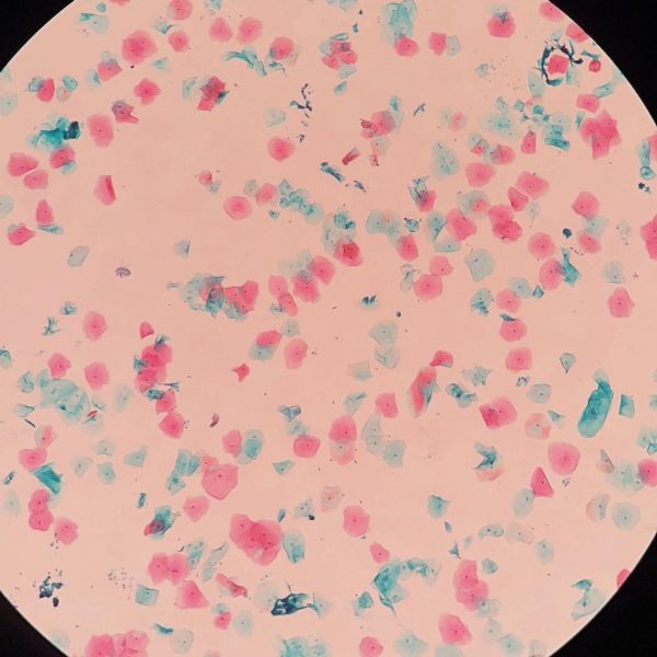 YGR® Adhesion Microscope Frosted Slide 75*25mm - Image 6